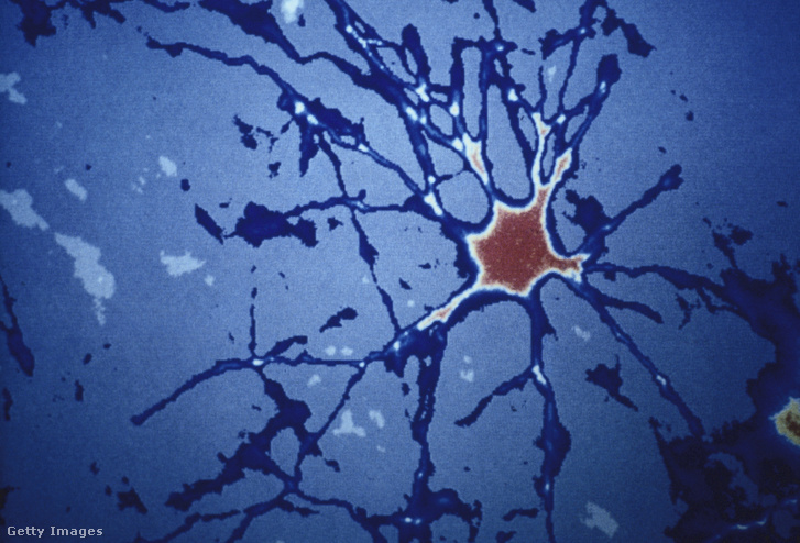 Emberi agysejtek gondolkodás közben Fotó: Yves Forestier / Getty Images Hungary