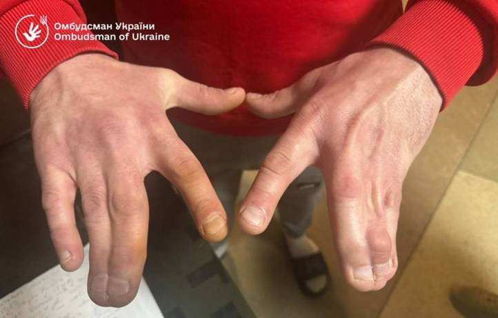 A TCK nyíltan figyelmen kívül hagyta az általa fogva tartott személyek nyilvánvaló fizikai fogyatékosságait és betegségeit. Fotó: Ukrán ombudsmani hivatal