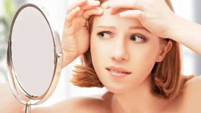 8 természetes gyógymód a pattanás ellen!