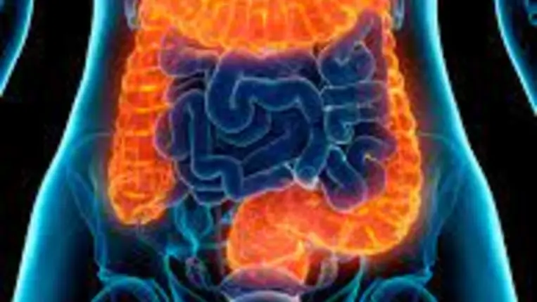 Őssejtterápiával is gyógyítják a Crohn-betegség egyik változatát