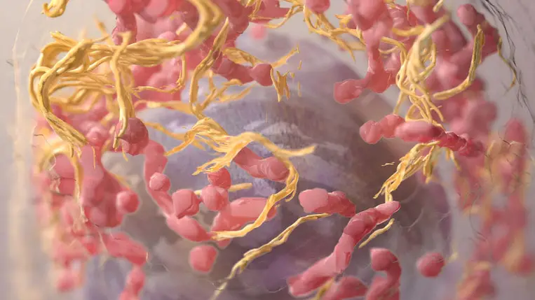 Mesterséges intelligencia segíthet a melanóma ellen