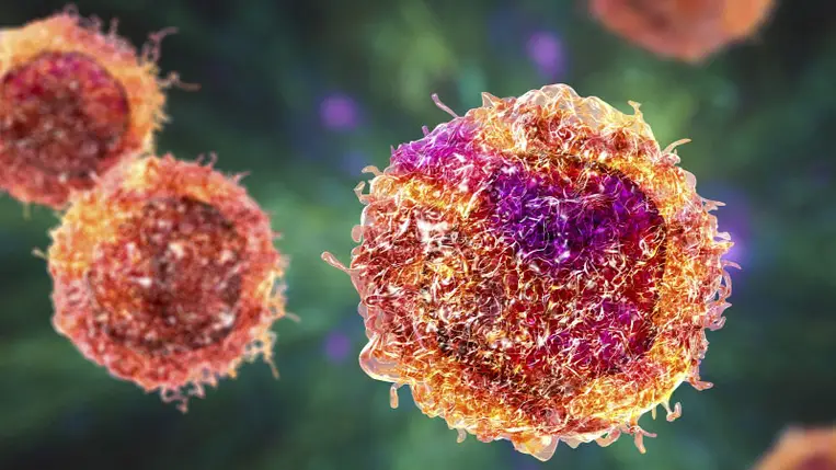 A rák gyenge pontját azonosíthatták magyar tudósok