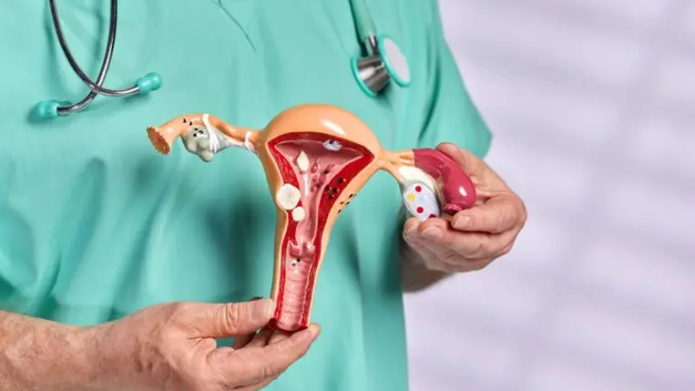 5 árulkodó tünet, mely rosszindulatú nőgyógyászati daganatot jelezhet