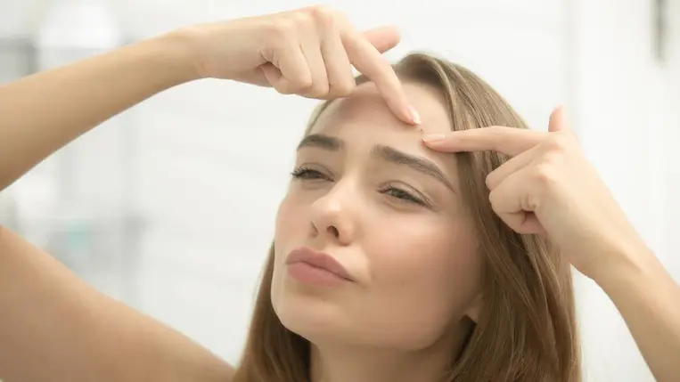 Ezt kend a pattanásra, hogy reggelre eltűnjön - Házi megoldások, de gyorsan hatnak