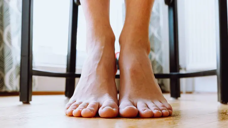 Így néz ki a körömgomba: hogy előzhető meg