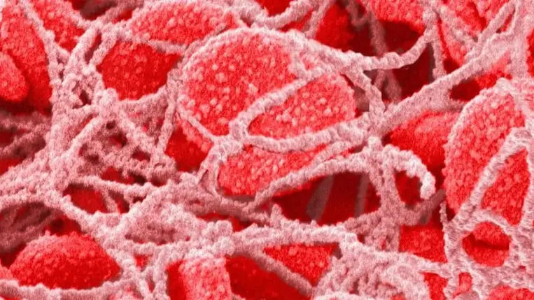 Hátborzongató felfedezés: rengeteg mikroműanyag van a vérünkben 