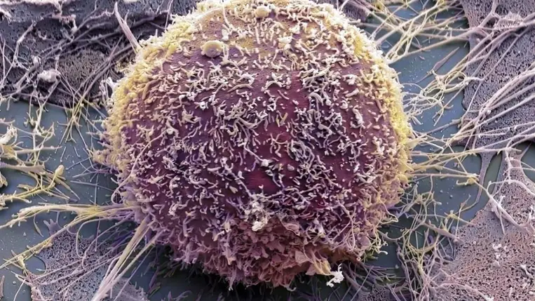 Fantasztikus felfedezés: átváltoztatták a rákos sejteket 