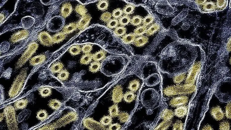 Borzasztó járvány törhet ki 