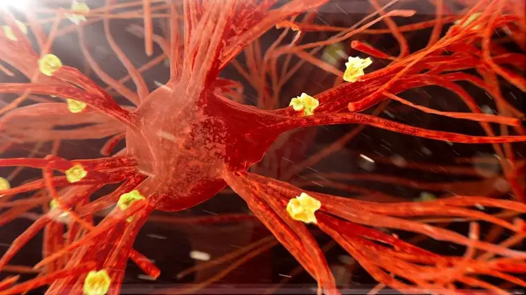 Egyszerű vérvizsgálat kimutatja az Alzheimer-kórt 