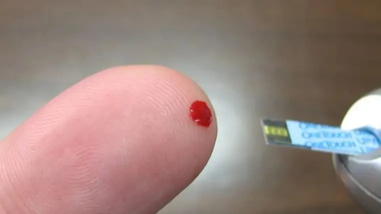 Ilyen korai jelek utalhatnak 2-es típusú cukorbetegségre 