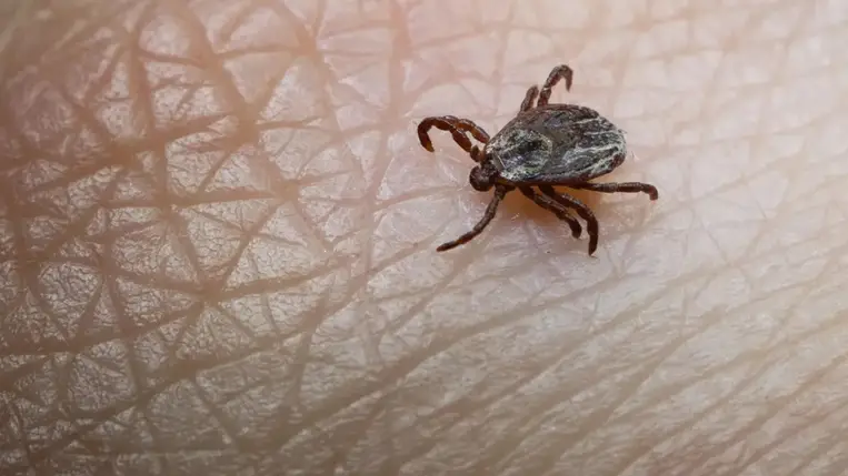 Ezt mindenképpen tegye meg, ha kullancs fúródik a bőrébe 