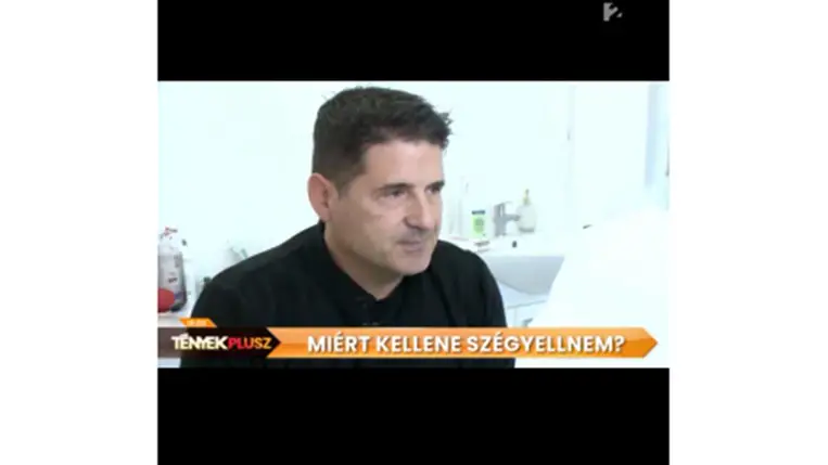 Hajdú Péter plasztikáztatta az arcát