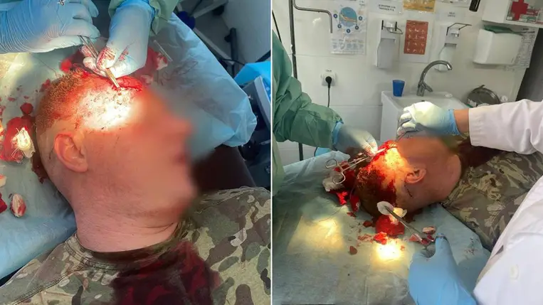 Két határőr, egy nő és egy kiskorú fiú is megsérült, amikor helyiek kövekkel megdobálták a határőröket. Fotó: Ukrán Állami Határőrszolgálat - DPSZU