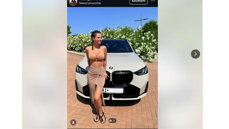 Nádai Anikó mellplasztikáján kiakadtak a kommentelők