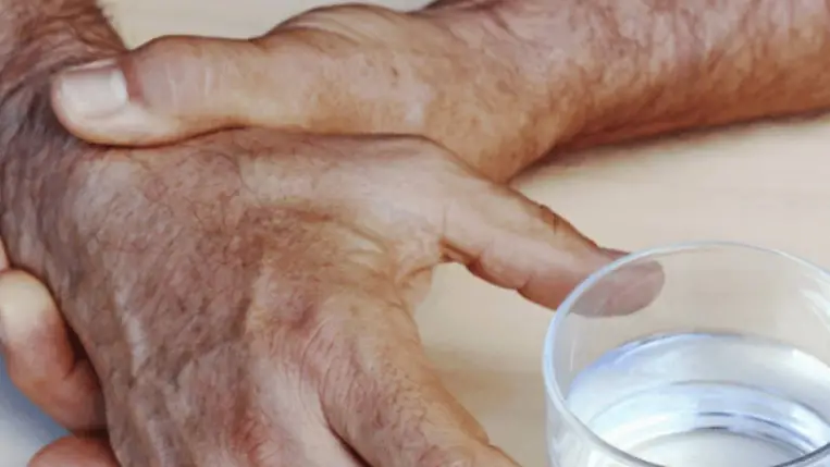 Kézremegés - a Parkinson-kór kezdetén nyugalomban jelentkezik 