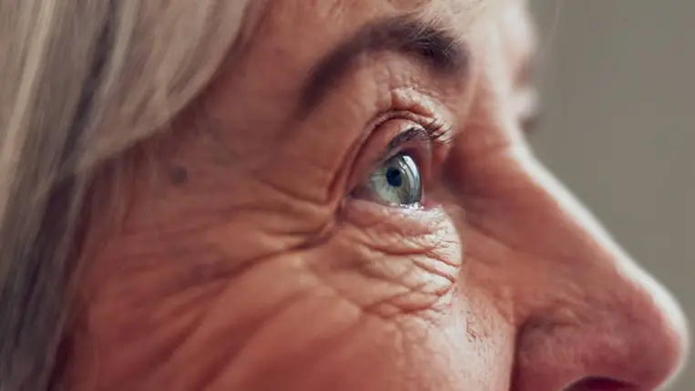 Súlyos agyi leépülést jelezhet, ha megváltozik a szem színe