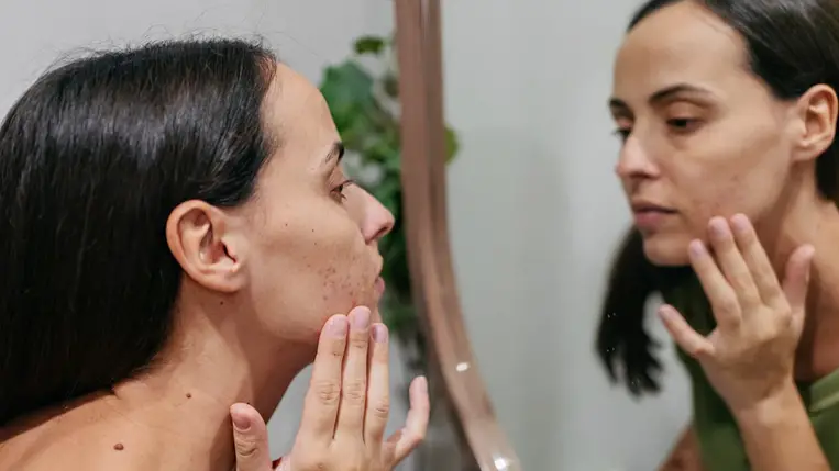 A tükörképed elárulja, milyen tápanyagra van szüksége a bőrödnek