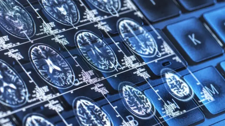 Megtalálták az ételt, ami véd az Alzheimer-kór ellen