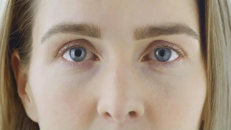 Az egyik legfontosabb ásványi anyag hiányzik, ha ilyen az arcod