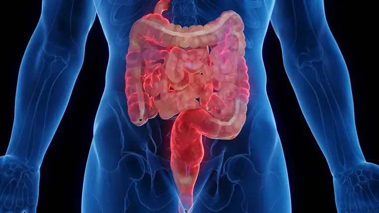 Rejtett veszély leselkedik a bélbetegekre – a csontvelőből indul a baj