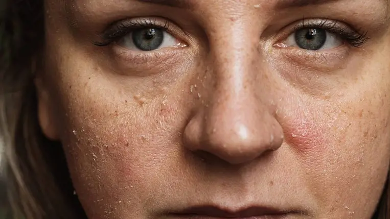 10 évet öregít rajtad ez a rossz szokás