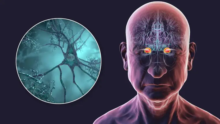 Megvan az étel, ami védhet a demencia ellen