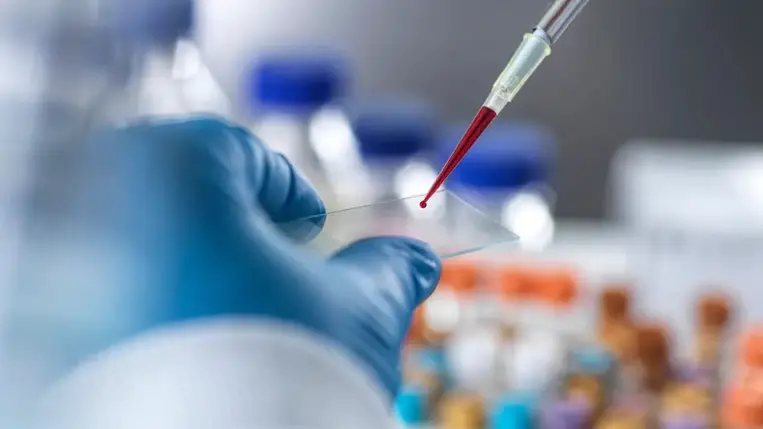 Ebola és hantavírus: tünetek, terjedés és felismerés
