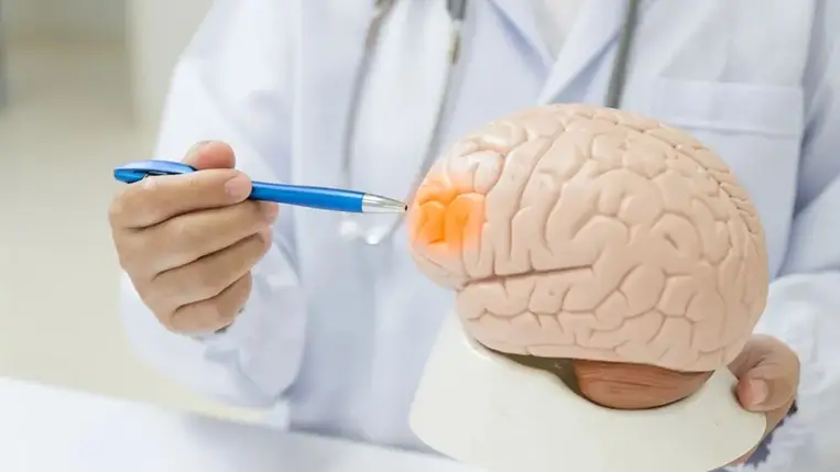 Meglepő kapcsolat: bizonyos ételek valóban védhetnek a stroke ellen