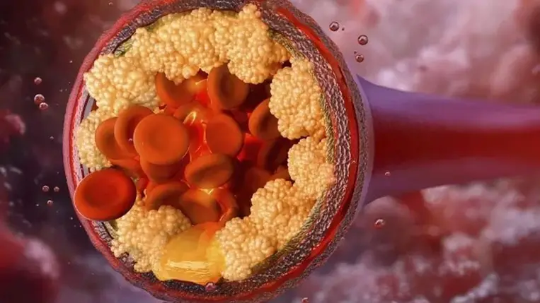 Ez a gyógyszer lehet a következő nagy dobás a szívbetegségek ellen