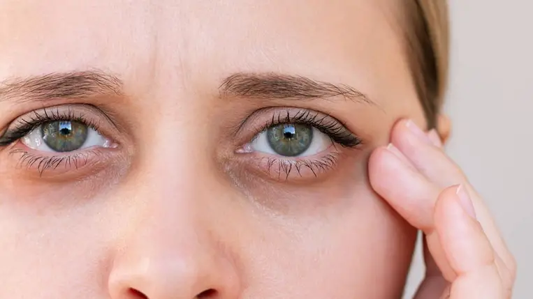 Karikás szemek, ráncos, száraz bőr – Meglepő dologra figyelmeztetnek a tünetek