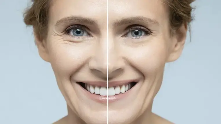 A kollagén feszesebbé teszi a bőrt - vajon véd a ráncok ellen is?