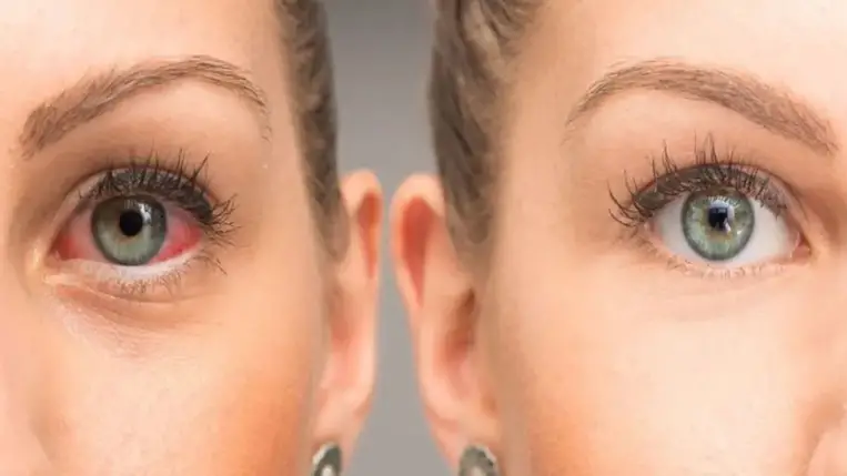 A látás megőrzésének egyik titka a jó minőségű szemészeti vizsgálat