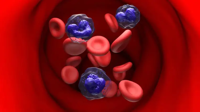 Ez lehet a leukémia legelső jele, amit eddig senki sem vett észre