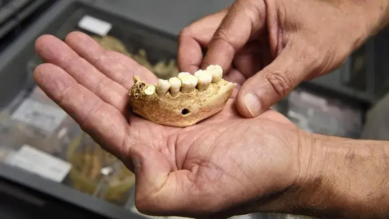 Megdöbbentő felfedezés: a neandervölgyiek közt is voltak fogorvosok