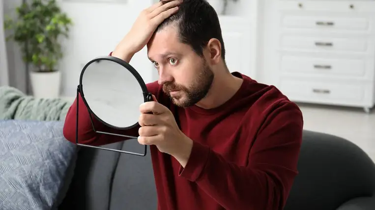 Jó hír a kopaszodó férfiaknak, hajnövesztő csodaszert mutattak be tajvani kutatók. Illusztráció. Fotó: Internet