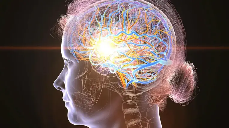 Hölgyek, figyelem! Ez a stroke megakadályozásának kulcsa