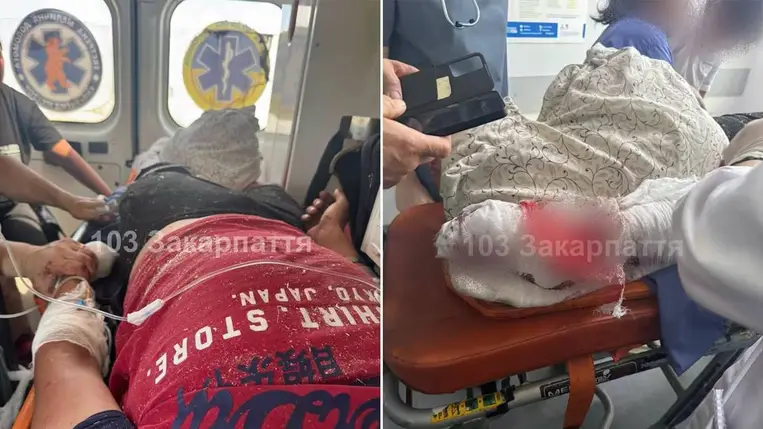 Súlyos körfűrész-baleset Kárpátalján – kritikus állapotban egy 17 éves fiú. Fotó: https://www.facebook.com/103zakarpat