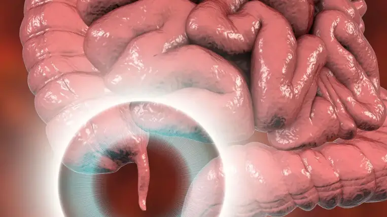 Súlyos tévedésben éltek az orvosok: kiderült, mi a vakbél valódi feladata