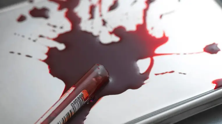 Nagyobb eséllyel lesz rákos, akinek ilyen a vércsoportja