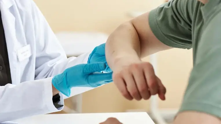 Apró piros pöttyök a bőrön: mikor ártalmatlanok és mikor nem?