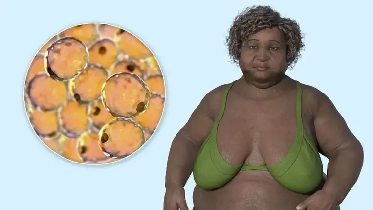 Ezt nem árulják el a fogyásról, pedig az élete múlthat rajta