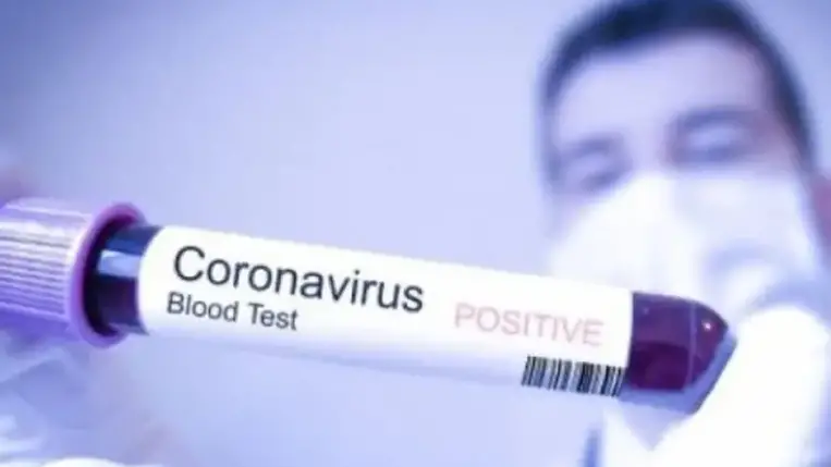  Az ukrán Egészségügyi Minisztérium újabb covid-antirekordokra számít 