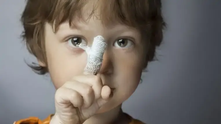 Miért ne jóddal fertőtlenítsük a sebet?