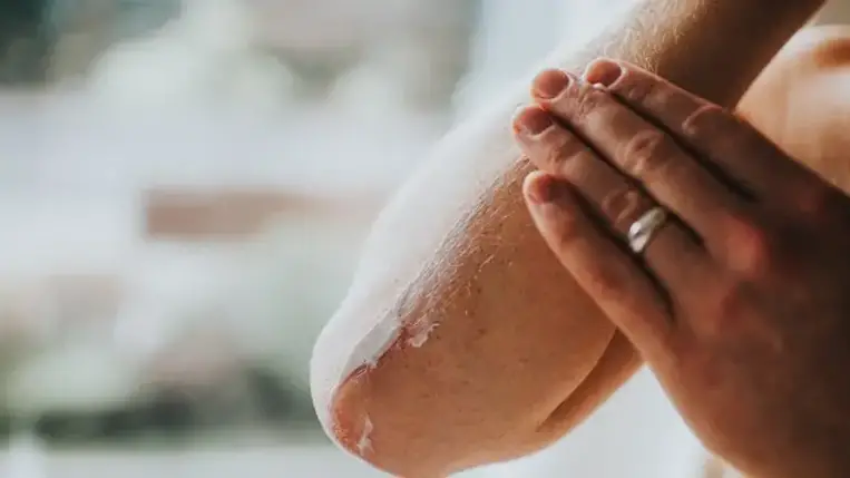 Így kezeljük a száradt, repedezett kezet