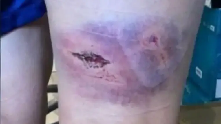 Iszonyúan néz ki a megvert francia focistanő