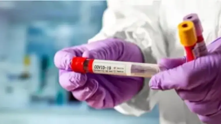 Oroszországban rekordot döntött napi halálozások száma