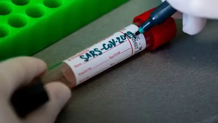 648 új fertőzöttet találtak Magyarországon