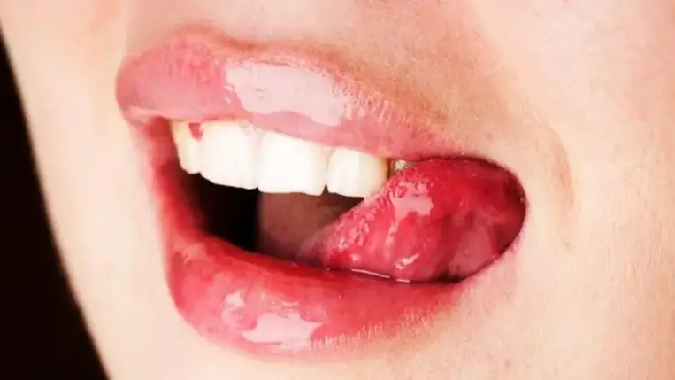 Gyorsítja a gyógyulást, ha megnyaljuk a sebet?