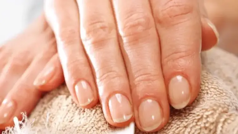 Körmeink ezt árulják el egészségünkről