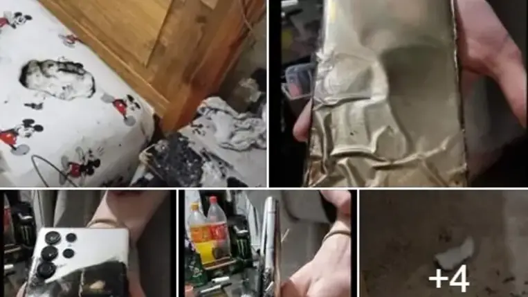 Felrobbant az okostelefonja, súlyosan megsérült